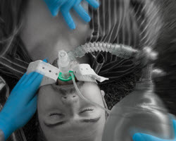igel_resus_image