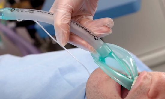 Das Intersurgical Larynxmasken Sortiment