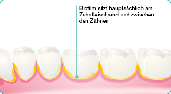 explore-image-oral-care-vap-facts-DE-VAP-Facts-2