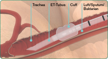 explore-image-oral-care-vap-facts-DE-VAP-Facts-3